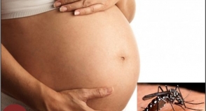 Orientações às gestantes sobre os casos de microcefalia